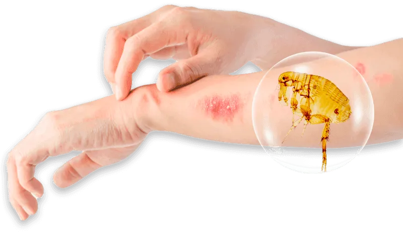 braccia con arrossamenti e bolle causa pulci